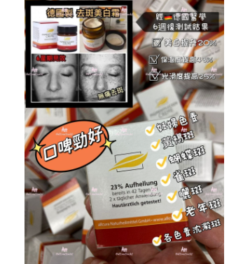 德國Pigmentflecken Creme 去斑美白霜 曬斑 雀斑 黃褐斑 妊娠色素 蝴蝶斑老年斑 色素沉澱斑 [平行進口]